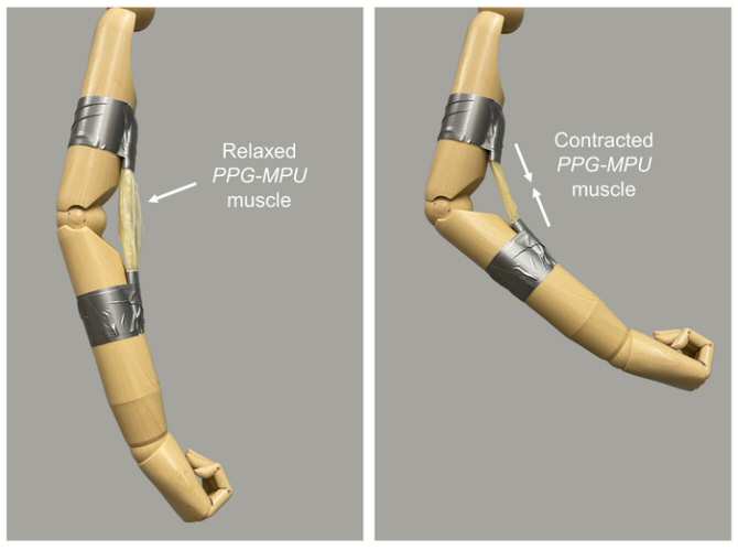 Orthopedic arm with artificial muscle comprised of prestrained films of PPG-MPU. When yhe PPG-MPU is relaxed, the arm is extended and when the PPG-MPU is contracted the arm is contracted as well.